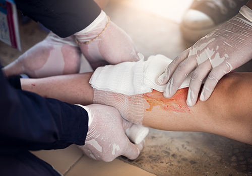 Wound Care Management